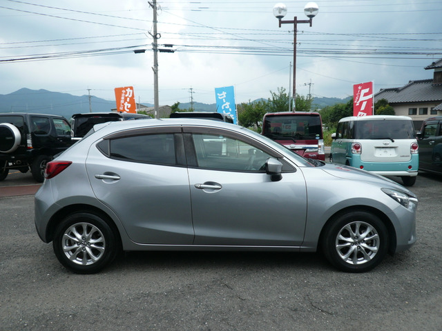 �ԑ̑S�̓I�ɁA�ׂ����L�Y���������݂���܂����A���悭�Y��ł��� ��[�[�[���Ƃ݂���킩��܂�