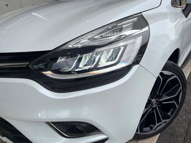 ���w�b�h���C�g:�w�b�h���C�g�͉��΂݂����Ȃ��A�Y��ȏ�Ԃ�ۂ��Ă���܂��B���΂ݖh�~�̃����Y�R�[�e�B���O�̎{�H���\�ł������܂��B