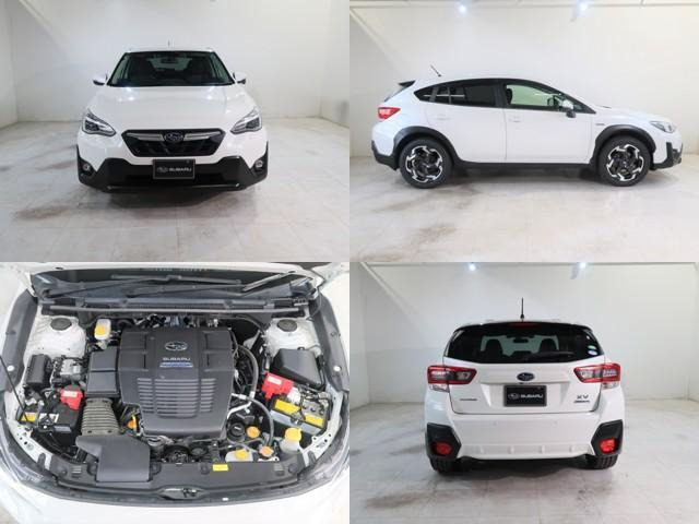 XV