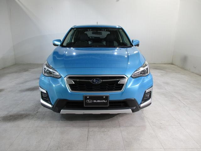 XV