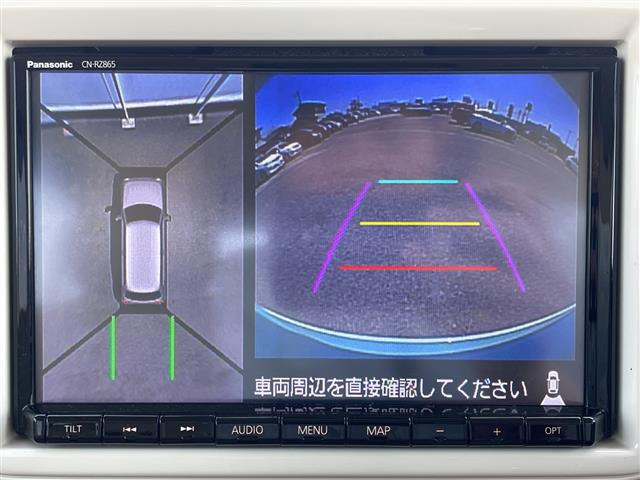 アルトラパンX