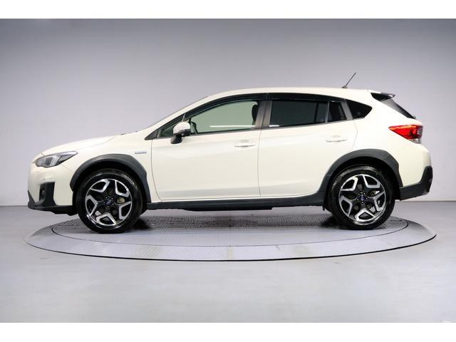 XV