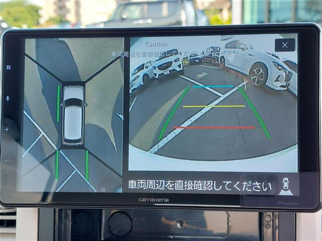 アルトラパンX
