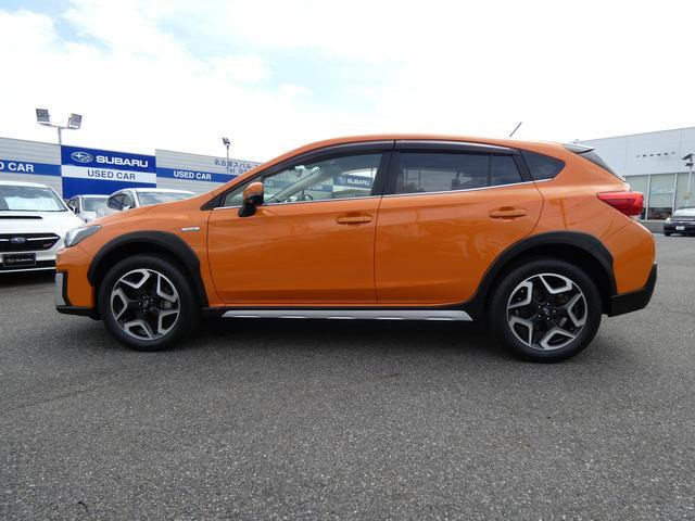 XV