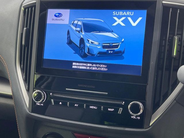 XV