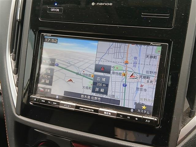 XV