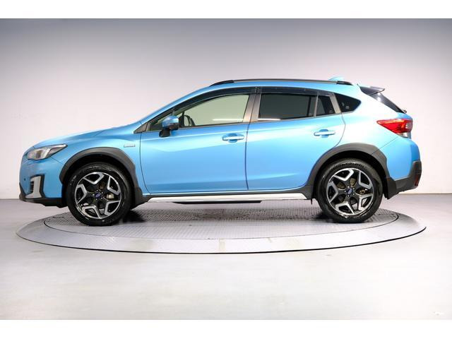 XV
