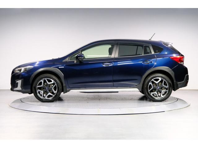 XV