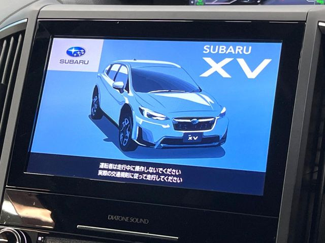 XV
