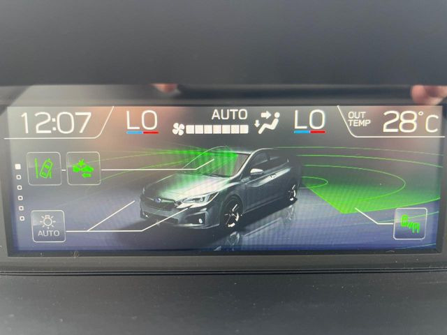 XV